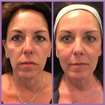 Beauty Microcurrent Facial Toning Massager – Lift, Tone & Rejuvenate Your Skin