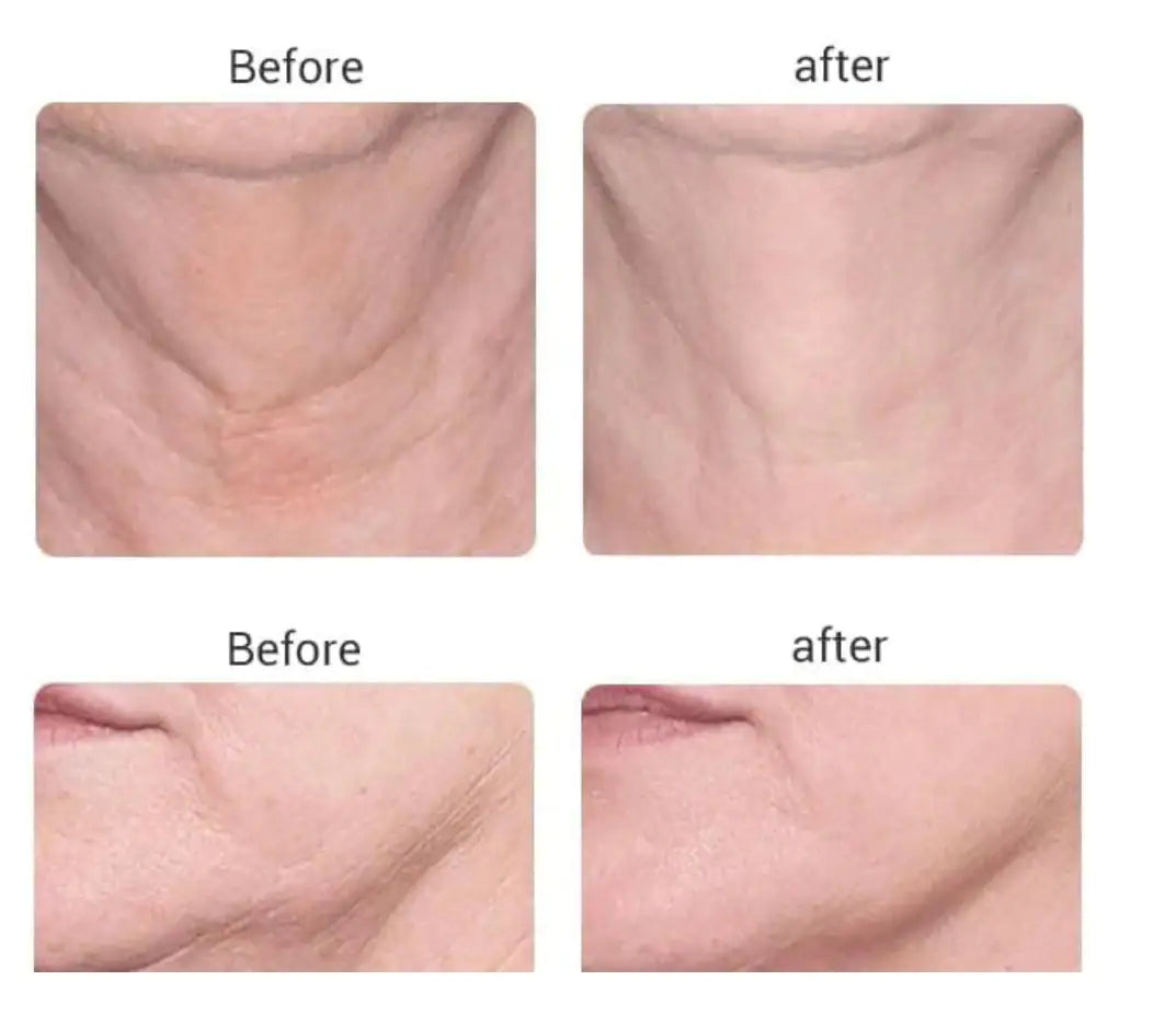 Beauty Microcurrent Facial Toning Massager – Lift, Tone & Rejuvenate Your Skin